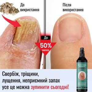Засіб проти грибка на ногах FungiStop